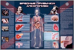 Электрифицированный стенд "Вредные привычки: алкоголизм" - fgospostavki.ru - Рыбинск