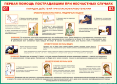 Таблица "Порядок действий при опасном кровотечении" (100х140 сантиметров, винил) - fgospostavki.ru - Рыбинск